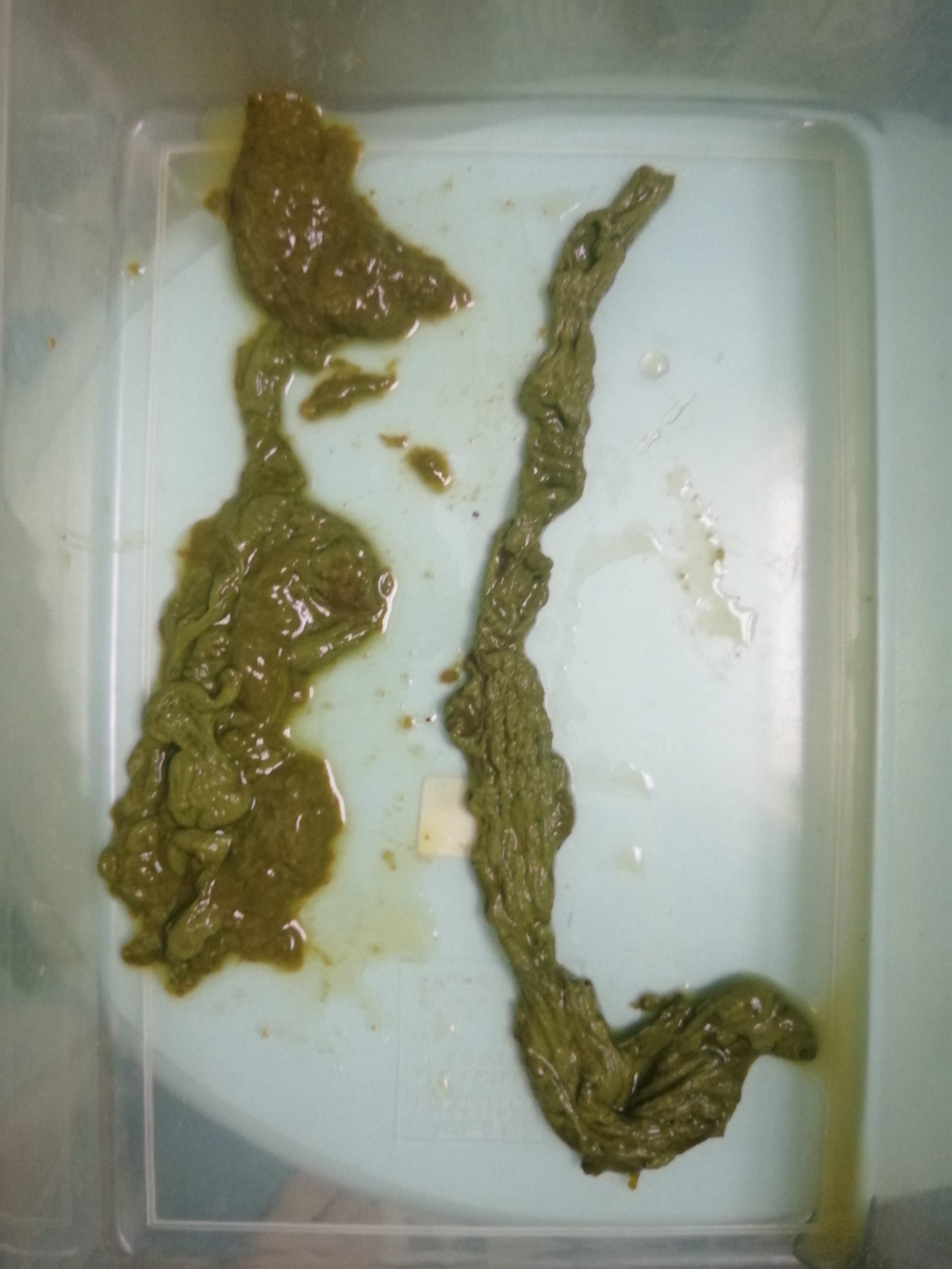 Placa Mucoide